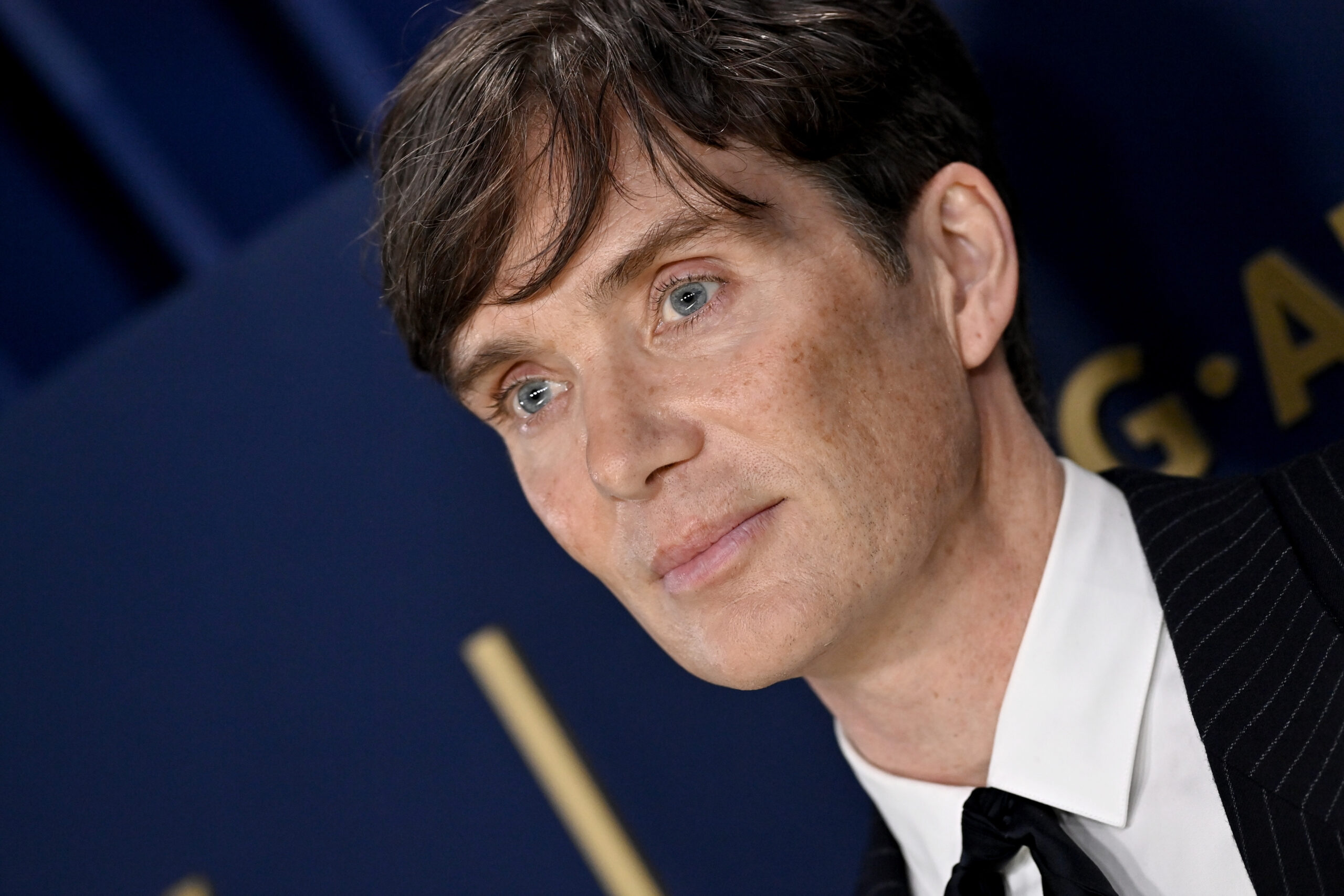 Cillian Murphy ‘smashed his head open’ while filming ‘Oppenheimer’: ‘I was a bit shocked’